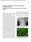 Research paper thumbnail of Pulmonary-renal syndrome as a clinical expression of multiple myeloma