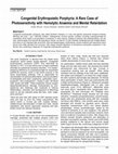 Research paper thumbnail of Congenital Erythropoietic Porphyria: A Rare Case of Photosensitivity with Hemolytic Anaemia and Mental Retardation