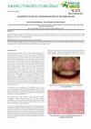 Research paper thumbnail of Aggressiveâ€ Clear Cell Chondrosarcoma of the Hard Palate