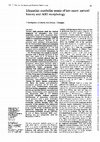 Research paper thumbnail of Idiopathic cerebellar ataxia of late onset: natural history and MRI morphology