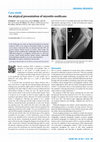 Research paper thumbnail of An atypical presentation of myositis ossificans