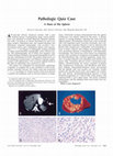 Research paper thumbnail of Pathologic Quiz Case: A Mass of the Spleen