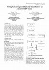 Research paper thumbnail of Kidney Tumor Segmentation and Classification using Deep Neural Network on CT Images