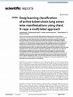 Research paper thumbnail of Deep learning classification of active tuberculosis lung zones wise manifestations using chest X-rays: a multi label approach