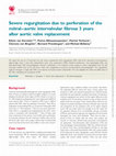 Research paper thumbnail of After Aortic