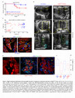 Research paper thumbnail of Exercise triggers CAPN1-mediated AIF truncation, inducing myocyte cell death in arrhythmogenic cardiomyopathy