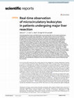 Research paper thumbnail of Real-time observation of microcirculatory leukocytes in patients undergoing major liver resection