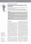 Research paper thumbnail of Thrombophlebitis of the internal jugular vein after tonsillectomy