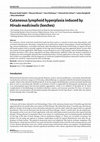 Research paper thumbnail of Cutaneous lymphoid hyperplasia induced by Hirudo medicinalis (leeches)