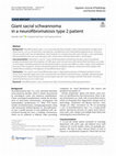 Research paper thumbnail of Giant sacral schwannoma in a neurofibromatosis type 2 patient