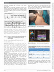 Research paper thumbnail of EP208 Usage of artificial intelligence-integrated usg in application of pectoral block type II in mastectomies