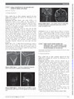 Research paper thumbnail of #35885 ‘Direct access’ patient pathway for ambulatory care – a service review. A safe sustainable access route to the operating theatre including via the block bay