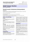 Research paper thumbnail of Smooth muscle: Intravenous leiomyomatosis