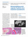 Research paper thumbnail of Hämatombildung nach vaginaler Punktion eines muzinösen Zystadenoms