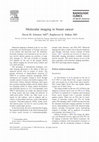 Research paper thumbnail of Molecular imaging in breast cancer