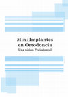 Research paper thumbnail of Mini implantes en Ortodoncia, Una visión periodontal