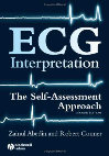 Research paper thumbnail of ECG interpretation