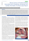 Research paper thumbnail of Brown Tumour of Posterior Maxilla Associated with Polydactyly, Syndactyly and Cardiac Anomalies: A Unique Case Report