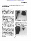 Research paper thumbnail of Perforation of intrathoracic colon causing acute pneumothorax