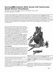 Research paper thumbnail of Successful Fibrinolysis After Acute Left Ventricular Assist Device Thrombosis