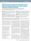 Research paper thumbnail of Angle of progression measurements of fetal head at term: a systematic comparison between open magnetic resonance imaging and transperineal ultrasound