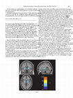 Research paper thumbnail of Increased gray matter volume of the basal ganglia – A morphometric fingerprint of presymptomatic compensation in genetically determined parkinsonism