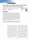 Research paper thumbnail of Re-eruption of an intruded immature permanent incisor with necrotic pulp: a case report