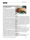 Research paper thumbnail of Naevoid hyperkeratosis of the nipple and areola