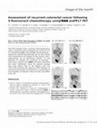 Research paper thumbnail of Assessment of recurrent colorectal cancer following 5-fluorouracil chemotherapy using both 18 FDG and 18 FLT PET