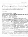 Research paper thumbnail of Potential impact of [ 18 F]3'-deoxy-3'-fluorothymidine versus [ 18 F]fluoro-2-deoxy-d-glucose in positron emission tomography for colorectal cancer