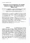 Research paper thumbnail of Comparison of echocardiography with magnetic resonance imaging in the assessment of the athlete's heart