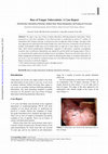 Research paper thumbnail of Base of tongue tuberculosis: a case report