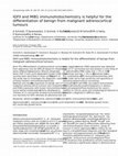 Research paper thumbnail of IGFII and MIB1 immunohistochemistry is helpful for the differentiation of benign from malignant adrenocortical tumours