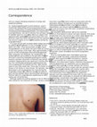 Research paper thumbnail of Hypereosinophilic dermatosis: skin lesions as the only manifestation of the idiopathic hypereosinophilic syndrome?