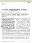 Research paper thumbnail of A syndrome of altered cardiovascular, craniofacial, neurocognitive and skeletal development caused by mutations in TGFBR1 or TGFBR2