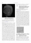 Research paper thumbnail of P2-004: Brain perfusion SPECT profile in posterior cortical atrophy