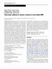 Research paper thumbnail of Visuo-motor pathways in humans revealed by event-related fMRI