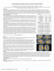 Research paper thumbnail of DTI tractography of theWernicke and Broca connectivity in right and left hander