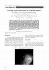 Research paper thumbnail of Gallium scan in diagnosing ocular sarcoidosis