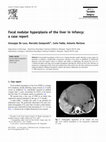 Research paper thumbnail of Focal nodular hyperplasia of the liver in infancy: a case report