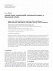 Research paper thumbnail of Amyloid Goiter Associated with Amyloidosis Secondary to Rheumatoid Arthritis