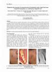 Research paper thumbnail of Diagnosis and treatment of cutaneous sinus of endodontic origin using Cone-beam computed tomography as a confirmatory diagnostic aid