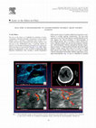 Research paper thumbnail of Real-Time Ultrasonography in Craniectomized Severely Brain Injured Patients