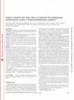 Research paper thumbnail of Intake of phenol-rich virgin olive oil improves the postprandial prothrombotic profile in hypercholesterolemic patients