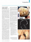 Research paper thumbnail of Cautery in medieval surgery: a unique palaeopathological case