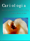 Research paper thumbnail of Odontologia Cariologia Frederico Barbosa de Sousa