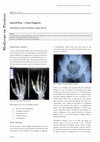 Research paper thumbnail of Spotted Bone - A Spot Diagnosis