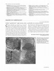 Research paper thumbnail of Isolated "superdominant" single coronary artery: a particularly rare coronary anomaly