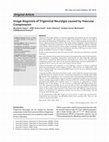 Research paper thumbnail of Image diagnosis of Trigeminal Neuralgia caused by Vascular Compression