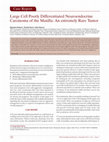 Research paper thumbnail of Case Report Large Cell Poorly Differentiated Neuroendocrine Carcinoma of the Maxilla : An extremely Rare Tumor